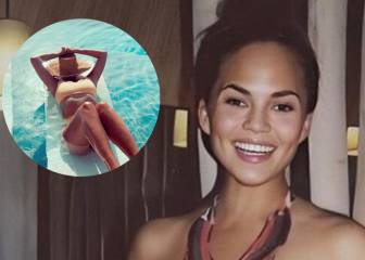 Chrissy Teigen comparte en topless sus quemaduras después de tomar el sol