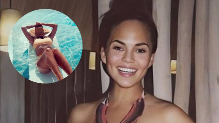 chrissy teigen topless reducción de pecho sol quemaduras tomar el sol bikini marca instagram stories