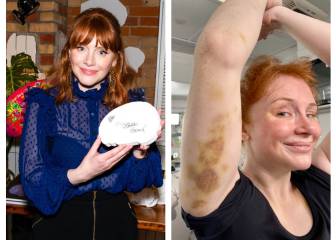 Bryce Dallas enseña las 'heridas de guerra’ que se ha hecho rodando Jurassic World