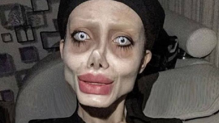 Sale a la luz el verdadero aspecto de la 'Angelina Jolie zombi': irreconocible