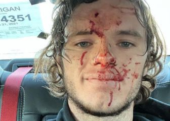 El youtuber 'WhistlinDiesel' se dispara en la cabeza