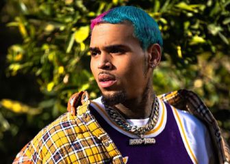 Una empleada de Chris Brown le denuncia tras sufrir el brutal ataque de su perro