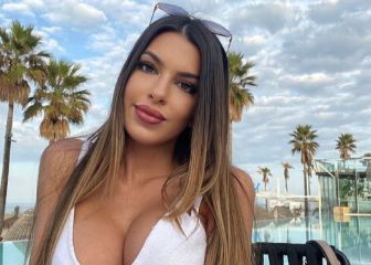 Andrea Gasca presume del resultado de su cirugía estética en Turquía