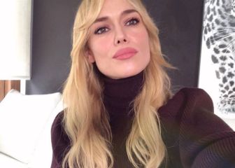 Patricia Conde confiesa la enfermedad que padece:
