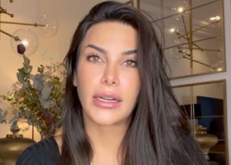 Carla Barber desvela su enfermedad incurable y con riesgo de muerte