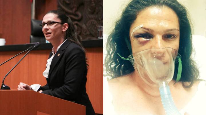 Ana Guevara, agredida y hospitalizada en México