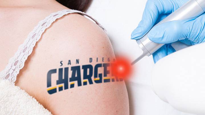Empresa quita tatuajes gratis a los hinchas de los Chargers