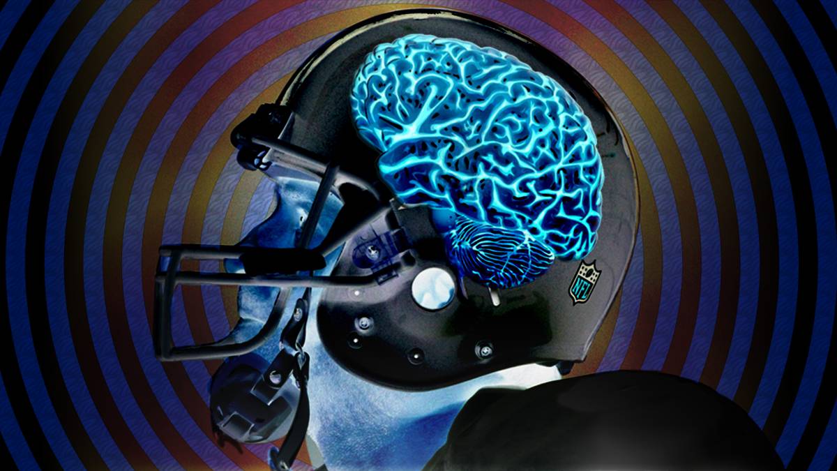 El CTE trae de cabeza a la NFL y su futuro.