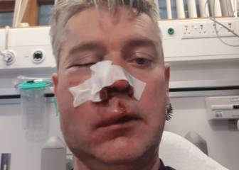 Árbitro sufrió lesiones severas tras actos violentos en Irlanda
