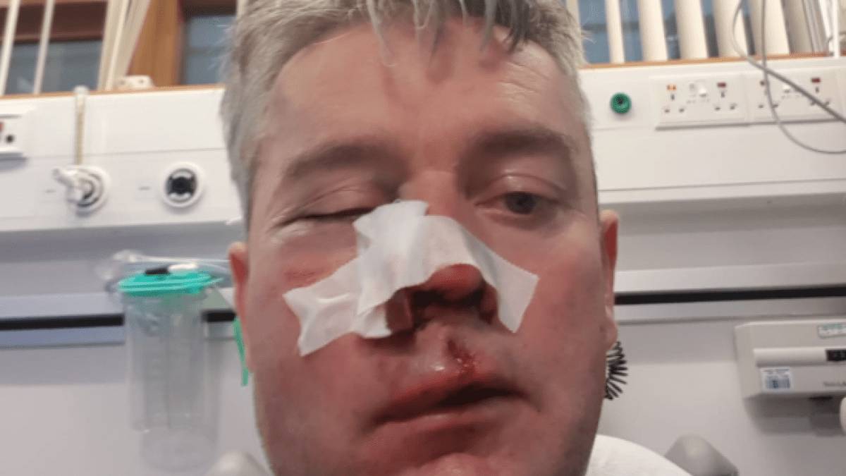 Árbitro sufrió lesiones severas tras actos violentos en Irlanda