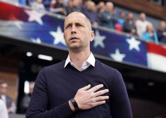 Para Costa Rica, perder ante USA fue ‘ganar un poco'