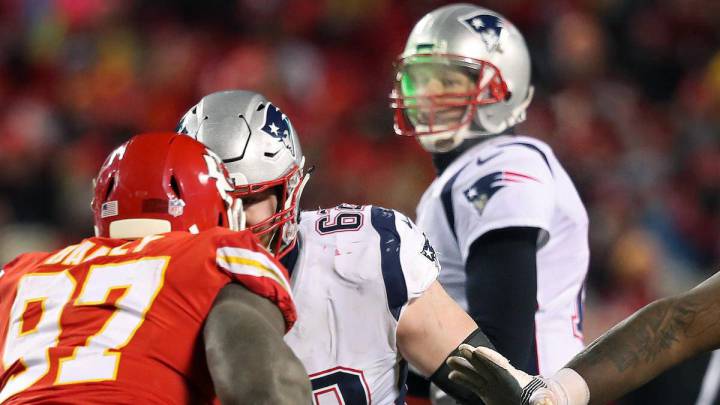 ¡En la cara no! Multan a sujeto que apuntó láser a Brady