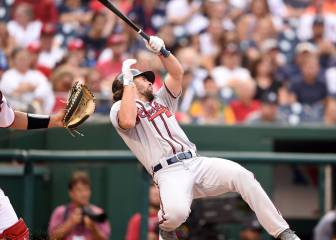 Los estragos del pelotazo que sufrió Charlie Culberson