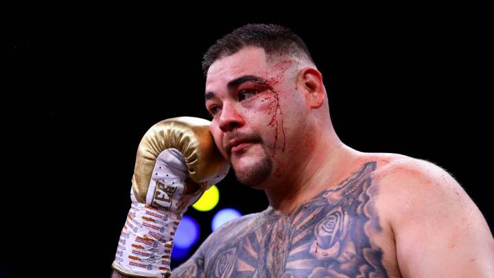 Dillian Whyte estalla contra Andy Ruiz: Es un gordo pedazo de mie...