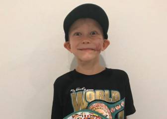 CMB nombra a niño de 6 años campeón honorario