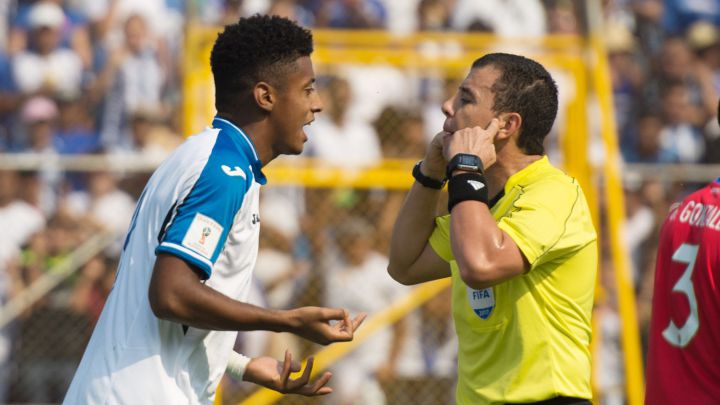 El delantero catracho se une a la baja de Alberth Elis y ambos delanteros se perderán el partido amistoso ante la selección de Guatemala.