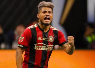 Josef no está descartado para el juego ante Philadelphia