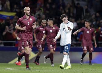 Argentina deprime a Messi