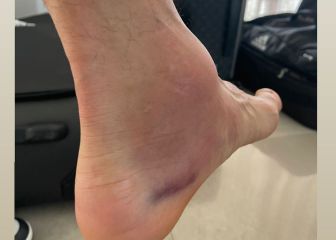 Di María pudo con todo