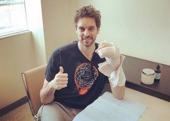 Pau Gasol muestra la mano operada: 