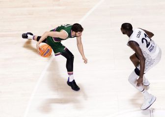 El Unicaja abusa del Dijon