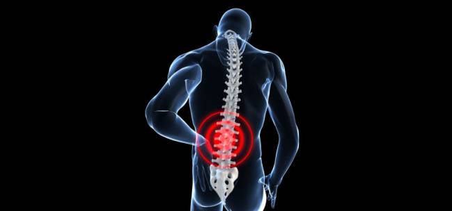 La lumbalgia es una de las principales causas de absentismo laboral.