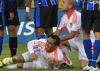 Ubilla sufre fractura de tibia y peroné ante Huachipato