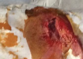 La dura imagen de la lesión de Echeverría: 