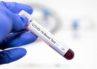 Test rápido del coronavirus: cómo funciona y cuánto tarda
