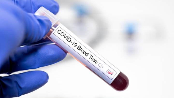Test rápido del coronavirus: cómo funciona y cuánto tarda