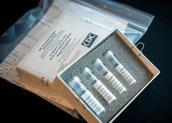 Prueba PCR con saliva: qué es, cómo funciona y cuándo comienza a aplicarse