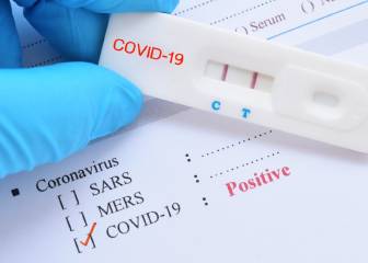 Examen PCR por COVID-19 a domicilio: cómo solicitar la prueba