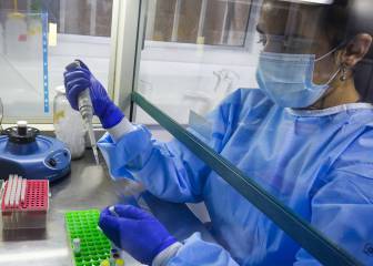 Chilenos desarrollan Inteligencia Artificial para detectar Covid 19 con radiografías