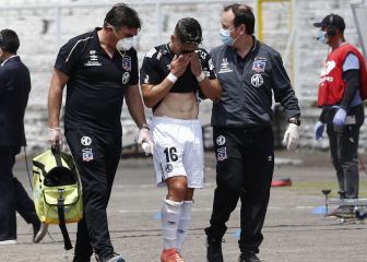 Opazo sufre grave lesión y complica aún más a Colo Colo