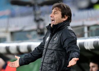 Conte le quita responsabilidad a Alexis y culpa a la 'Diosa Fortuna'