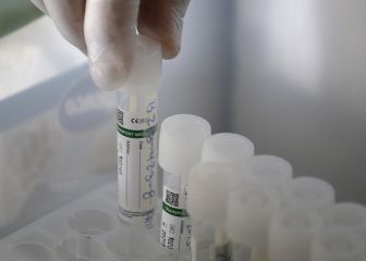 Coronavirus en Chile y comunas en cuarentena: calendario de vacunación | Última hora de hoy, 29 de marzo