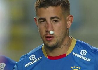 Ensangrentado y desfigurado: así quedó el rostro de Holgado