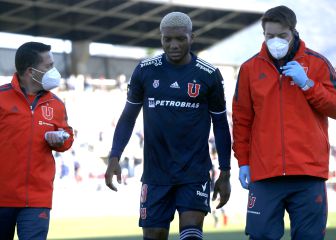 La U sufre 5 sensibles bajas en el duelo ante Antofagasta
