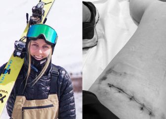 De estar 8 meses sin trotar a sus terceros JJ.OO: 