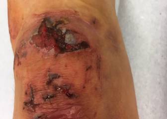 Una ciclista muestra la dureza del ciclocross en sus piernas