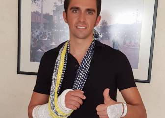 Contador, intervenido con éxito de un tendón de la muñeca