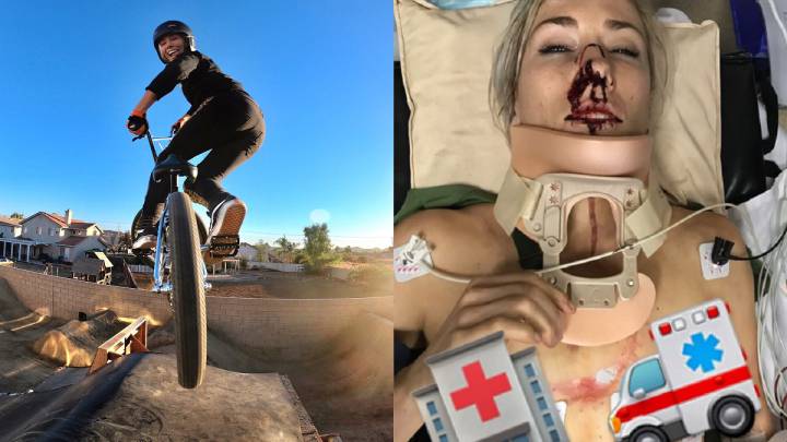 Caroline Buchanan rueda con su bici de BMX y mostró su heridas desde el hospital tras ser atropellada por un coche.