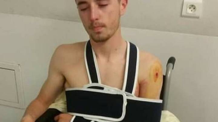 El ciclista francés Clément Delcros posa tras ser disparado en un hombro mientras entrenaba.