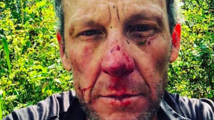 Armstrong sufre una dura caída: su rostro lo dice todo