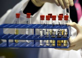 Un experto en dopaje que defendió a Armstrong, sancionado tras dar positivo