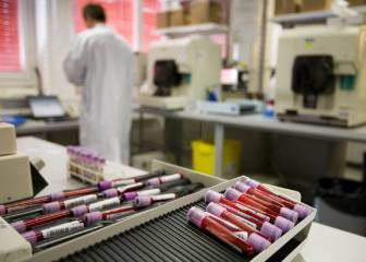 Los controles antidopaje en el ciclismo cayeron un 90% por la pandemia