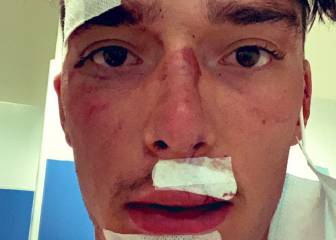 Dura caída de Simon Pellaud tras fallarle los frenos de disco