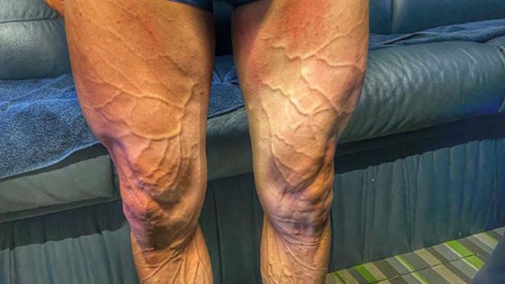Imagen de las piernas de José Joaquín Rojas antes de la octava etapa de La Vuelta.