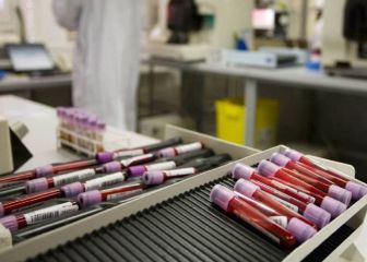 La UCI celebra la prohibición de la AMA a los glucocorticoides