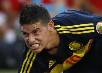 James, en fisioterapia y trabajo de recuperación para Colombia